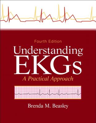 Understanding EKGs: A Practical Approach