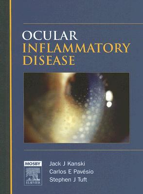 Ocular Inflammatory Disease
