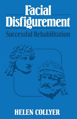 Facial Disfigurement : Successful Rehabilitation