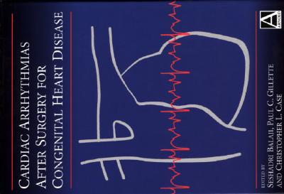 Cardiac Arrythmias After Surgery for Congenital Heart Disease