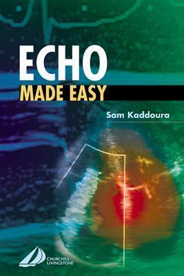 Image for Echo Made Easy Echo Made Easy