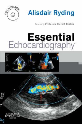 Essential Echocardiography