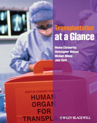 Transplantation at a Glance [Paperback] Clatworthy, Menna; Watson, Christopher; Allison, Michael and Dark, John