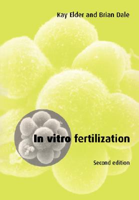 In Vitro Fertilization (Volume 0)