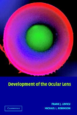 Image for Development of the Ocular Lens Development of the Ocular Lens