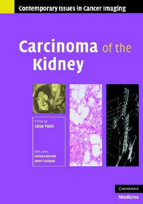 Carcinoma of the Kidney (Contemporary Issues in Cancer Imaging) [Hardcover] Patel, Uday
