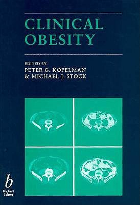 Clinical Obesity