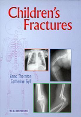 Children's Fractures: A Radiological Guide to Safe Practice