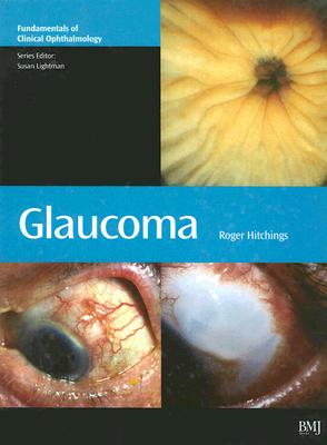 Glaucoma: Fundamentals Of Clinical Opthalmology