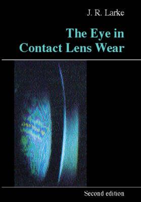 Eye in Contact Lens Wear