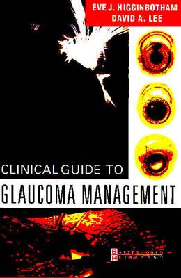 Clinical Guide to Glaucoma Management