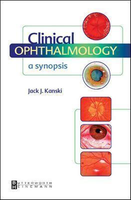 Clinical Ophthalmology: A Synopsis