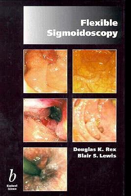 Flexible Sigmoidoscopy