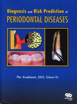 Diagnosis and Risk Prediction of Periodontal Diseases (Axelsson Series on Preventive Dentistry)