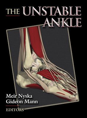 Unstable Ankle