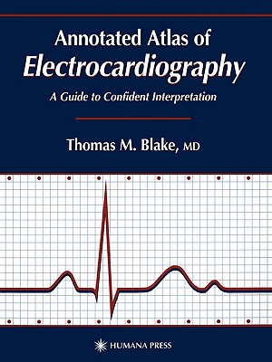 Annotated Atlas of Electrocardiography: A Guide to Confident Interpretation [Contemporary Cardiology 3.]