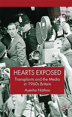 Hearts Exposed: Transplants and the Media in 1960s Britain (Science, Technology and Medicine in Modern History)