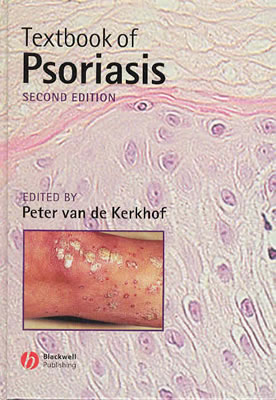 Textbook of Psoriasis