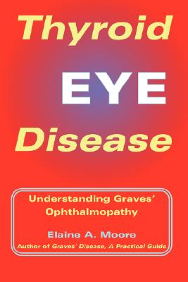 Thyroid Eye Disease: Understanding Graves' Ophthalmopathy