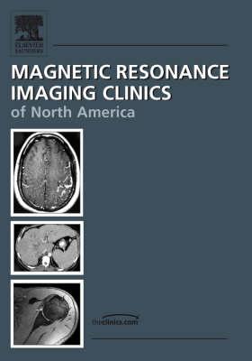 Breast MR Imaging [Magnetic Resonance Imaging Clinics, Volume 14, No. 3]