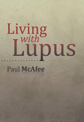 Living with Lupus Image for Living with Lupus