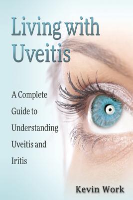 Living with Uveitis: A Complete Guide to Uveitis and Iritis