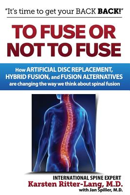 To Fuse or Not to Fuse: How Artificial Disc Replacement, Hybrid Fusion, and Fusion Alternatives are Changing the Way We Think about Spinal Fusion