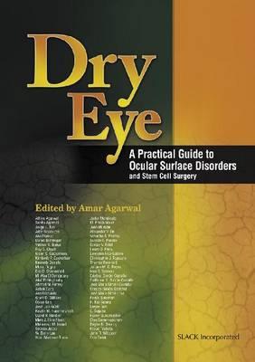 Dry Eye: A Practical Guide to Ocular Surface Disorders and Stem Cell Surgery