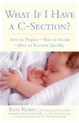 What If I Have a C-Section