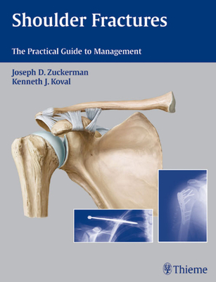 Shoulder Fractures: The Practical Guide to Management