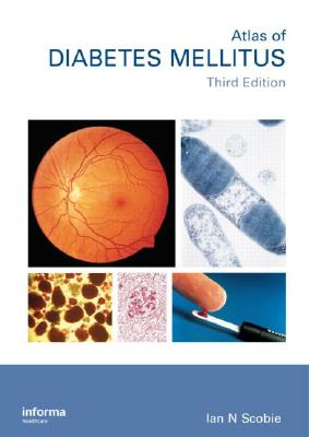 An Atlas of Diabetes Mellitus, Second Edition (Encyclopedia of Visual Medicine Series)