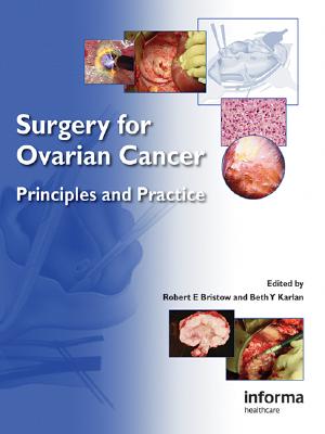 Surgery for Ovarian Cancer: Principles and Practice