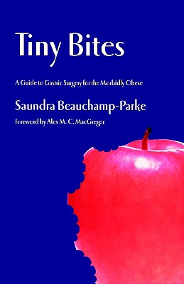 Image for Tiny Bites: A Guide to Gastric Surgery for the Morbidly Obese