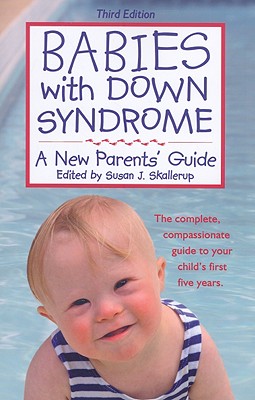 Babies With Down Syndrome: A New Parents' Guide