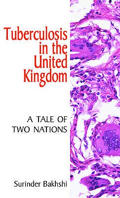Tuberculosis in the United Kingdom: A Tale of Two Nations