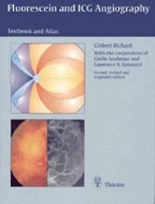 Fluorescein angiography: Textbook and atlas