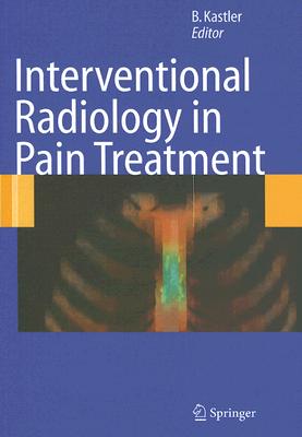 Interventional Radiology in Pain Treatment